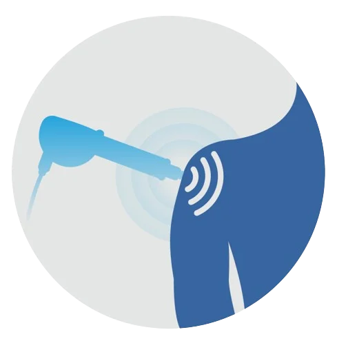 Shockwave Therapy