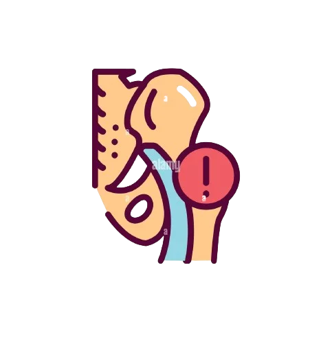 Sciatica