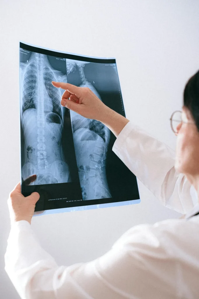 slipped disc treatment doctor with xray tio chiro