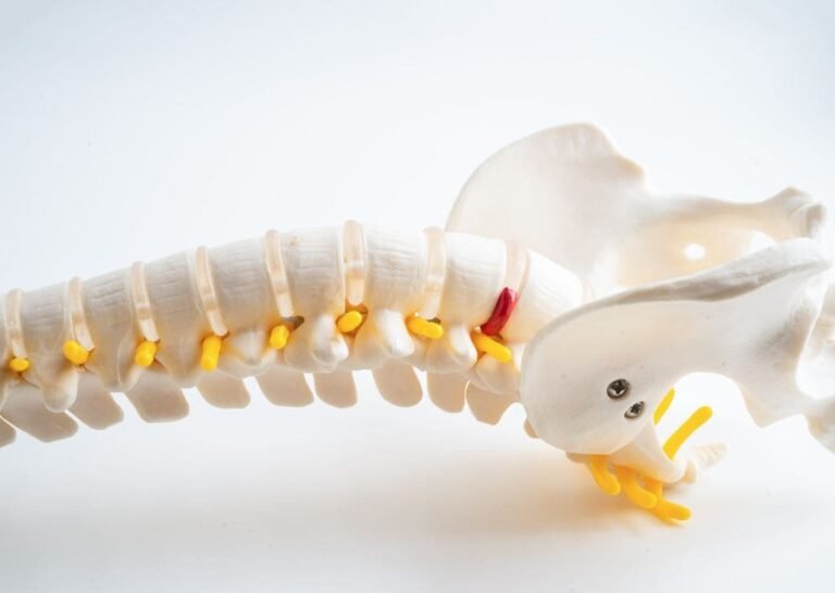 Physiotherapist showing how to heal from a herniated disc with a skeletal model.