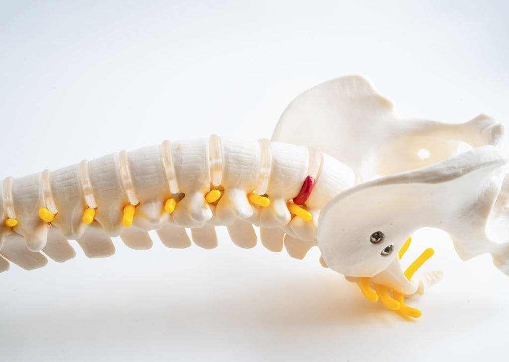 Physiotherapist showing how to heal from a herniated disc with a skeletal model.