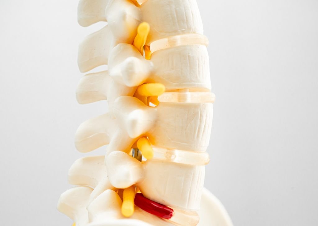 A spine model used to explain a slipped disc to patients at Petaling Jaya, Tio Chiro & Physio