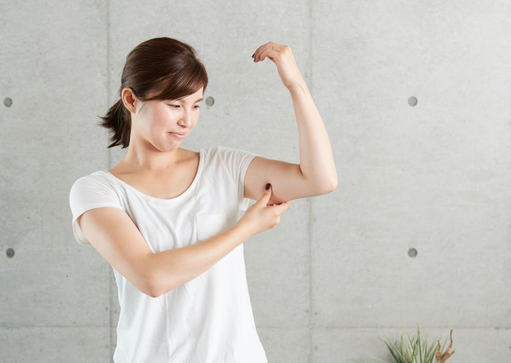 A female patient experiencing muscle weakness likely caused by a slipped disc.