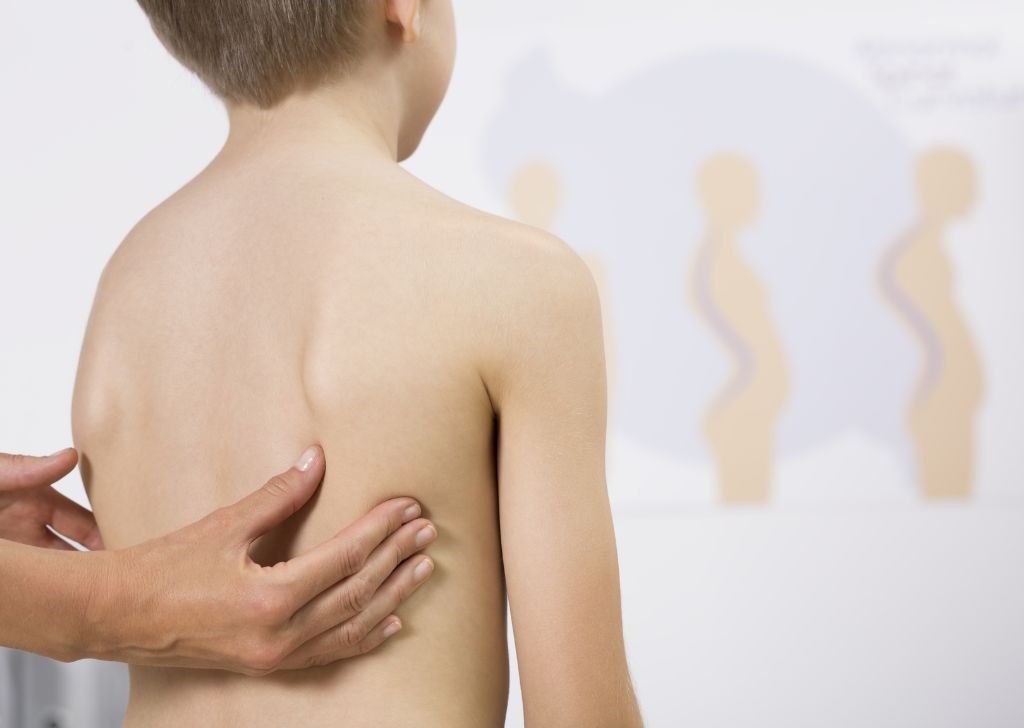 A child with scoliosis getting checked by a physiotherapist in Petaling Jaya.